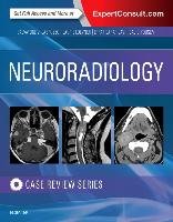 Neuroradiology Imaging Case Review Labruzzo Salvatore V.