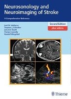 Neurosonology and Neuroimaging of Stroke Valdueza Jose Manuel, Schreiber Stephan, Rohl Jens-Eric, Connolly Florian, Klingebiel Randolf