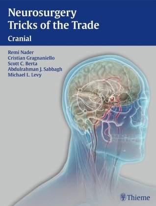 Neurosurgery Tricks of the Trade - Cranial: Cranial Thieme Medical Publ Inc., Thieme Medical Publishers