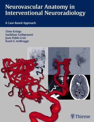 Neurovascular Anatomy in Interventional Neuroradiology: A Case-Based Approach Krings Timo, Geibprasert Sasikhan, Ter Brugge Karel