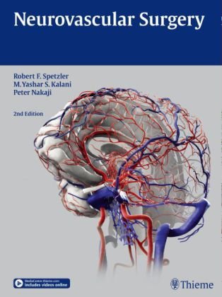 Neurovascular Surgery Robert F. Spetzler