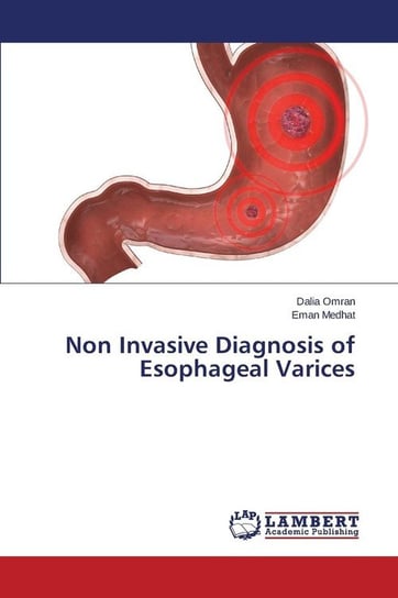 Non Invasive Diagnosis of Esophageal Varices Omran Dalia