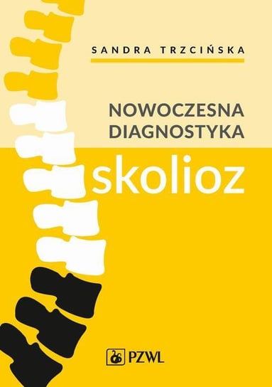 Nowoczesna diagnostyka skolioz Sandra Trzcińska