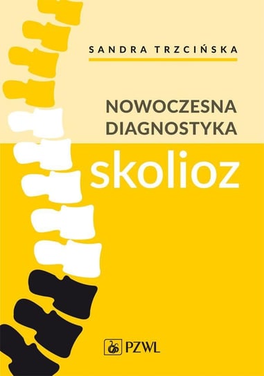 Nowoczesna diagnostyka skolioz Sandra Trzcińska, Kamil Koszela, Andrzej Myśliwiec, Arkadiusz Żurawski