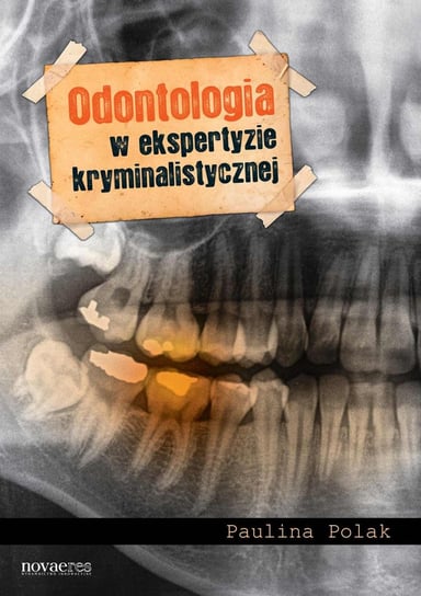 Odontologia w ekspertyzie kryminalistycznej Polak Paulina