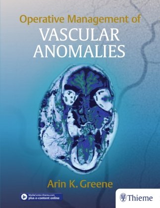 Operative Management of Vascular Anomalies Thieme Georg Verlag, Thieme Medical Publishers