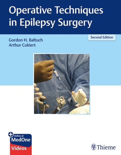 Operative Techniques in Epilepsy Surgery Gordon H. Baltuch, Arthur Cukiert