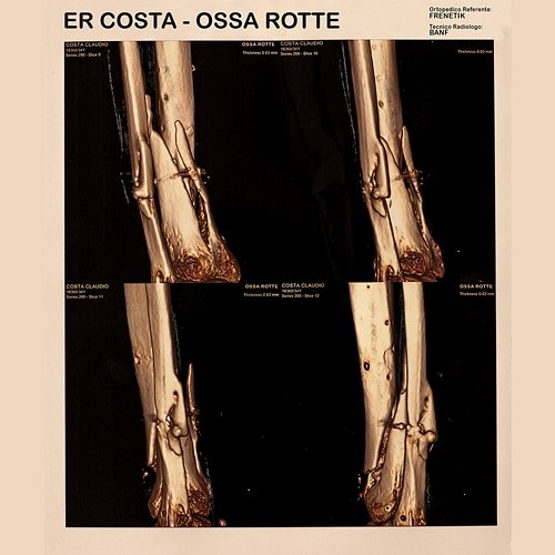 Ossa rotte Er Costa