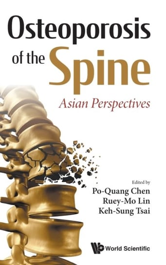Osteoporosis Of The Spine: Asian Perspectives Opracowanie zbiorowe