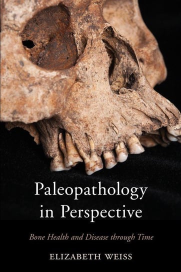 Paleopathology in Perspective Weiss Elizabeth