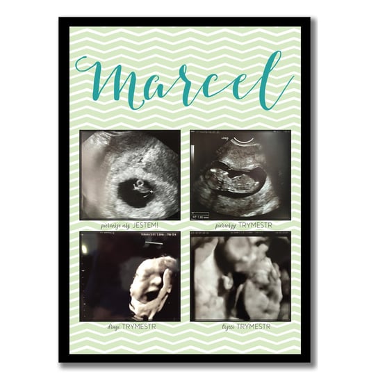 Pamiątka ciąży, plakat ze zdjęciami usg dla chłopca, Sowia Aleja Inna marka