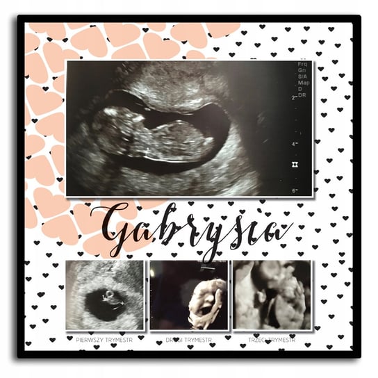Pamiątka z ciąży, zdjęcia USG, trymesty ciąży Inna marka