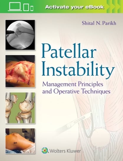 Patellar Instability: Management Principles and Operative Techniques Parikh Shital