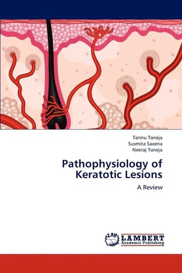 Pathophysiology of Keratotic Lesions Taneja Tannu