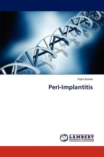 Peri-Implantitis Kumar Vipin