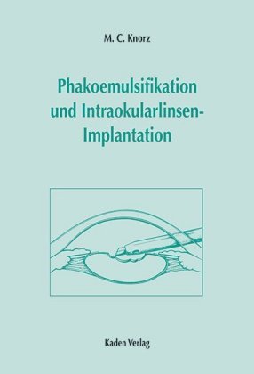 Phakoemulsifikation und Intraokularlinsenimplantation, m. CD-ROM Kaden Verlag