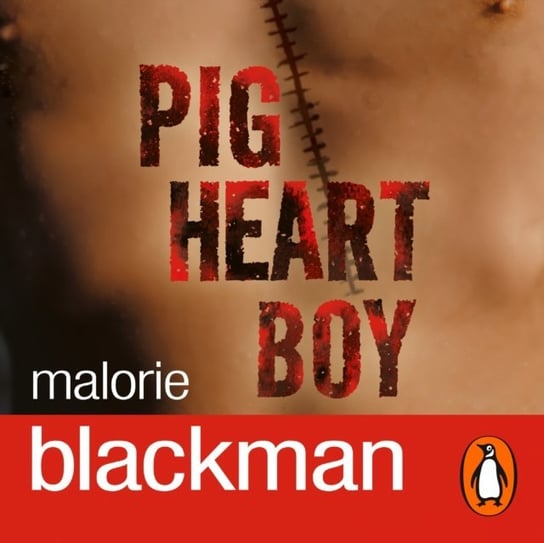 Pig-Heart Boy Blackman Malorie