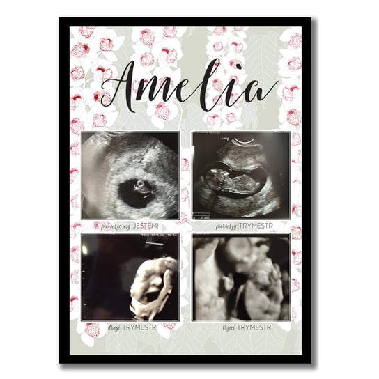 Plakat, pamiątka z ciąży ze zdjęciami z usg, trymesty ciąży, Sowia Aleja Inna marka