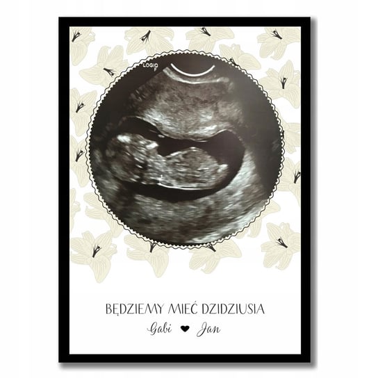 Plakat powitalny dla maluszka, USG, na narodziny, pamiątka z ciąży, ciąża, usg, Sowia Aleja Inna marka