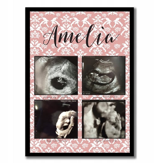 Plakat - Trymestry ciąży, zdjęcia USG, pamiątka z ciąży, prezent na Baby Shower, ciąża, Sowia Aleja Inna marka