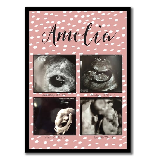 Plakat w kropki z trymestrami ciąży, pamiątka z usg, Sowia Aleja Inna marka