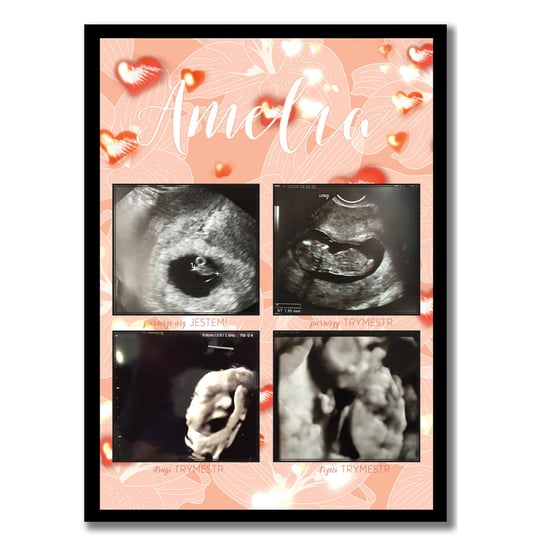 Plakat z trymestrami ciąży, zdjęcia USG, pamiątka z ciąży prezent, ciąża, trymestry, z imieniem, Sowia Aleja Inna marka