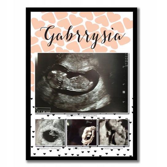 Plakat ze zdjęciami usg 3 trymestry ciąży pamiątka, kolaż Sowia Aleja Inna marka