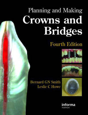 Planning and Making Crowns and Bridges Smith Bernard G. N., Howe Leslie C.