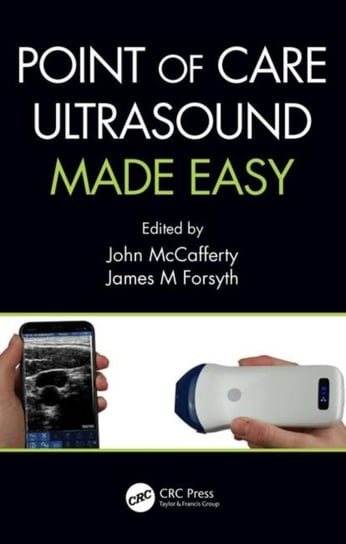 Point of Care Ultrasound Made Easy Opracowanie zbiorowe