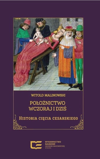 Położnictwo wczoraj i dziś. Historia cięcia cesarskiego Witold Malinowski