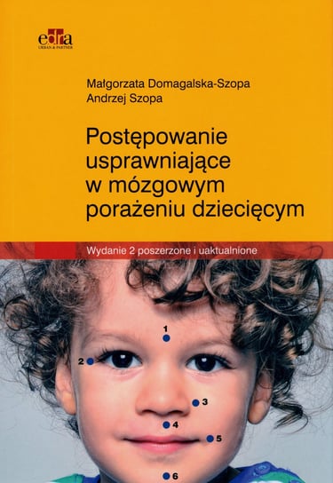Postępowanie usprawniające w mózgowym porażeniu dziecięcym Małgorzata Domagalska-Szopa, Szopa Andrzej