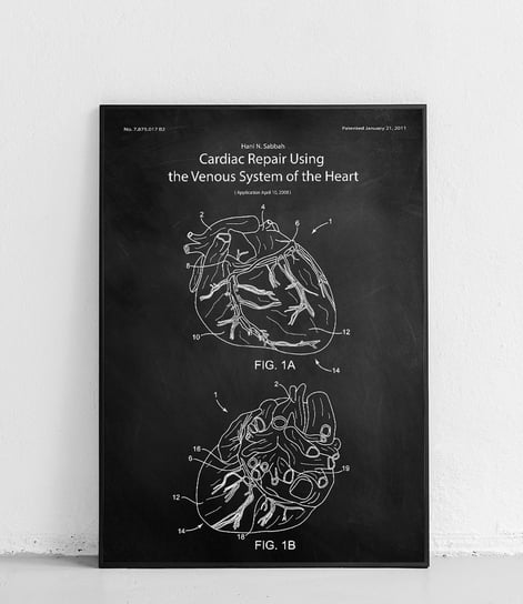 Poster Polytechnic, Metoda leczenia chorób serca - plakat Poster Polytechnic