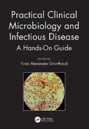 Practical Clinical Microbiology and Infectious Diseases: A Hands-On Guide Opracowanie zbiorowe