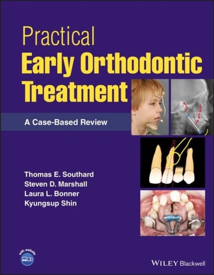 Practical Early Orthodontic Treatment: A Case-Based Review Opracowanie zbiorowe