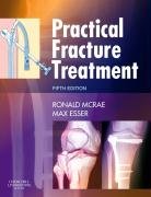 Practical Fracture Treatment McRae Ronald