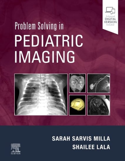 Problem Solving in Pediatric Imaging Opracowanie zbiorowe