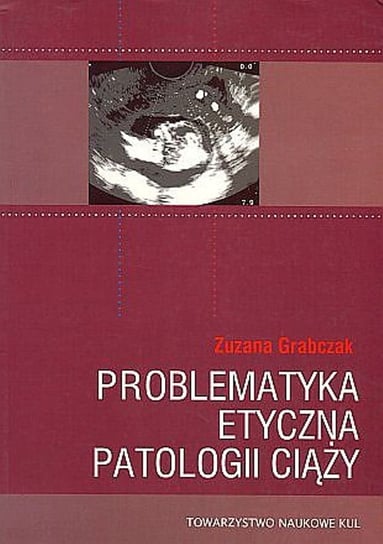 Problematyka etyczna patologii ciąży Grabczak Zuzana