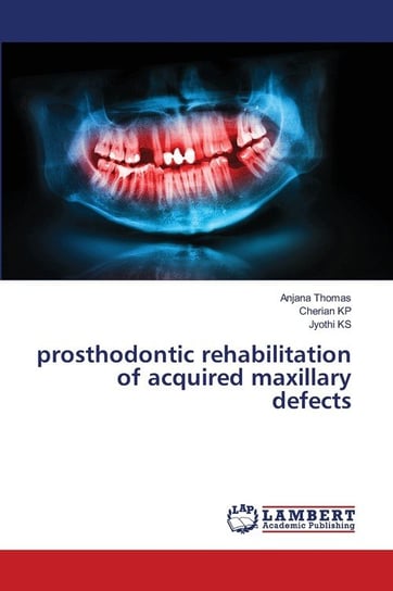 prosthodontic rehabilitation of acquired maxillary defects Thomas Anjana
