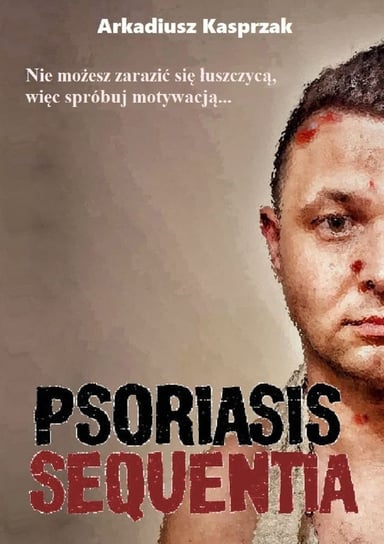 Psoriasis Sequentia Kasprzak Arkadiusz