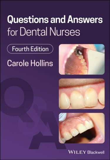 Questions and Answers for Dental Nurses Carole Hollins