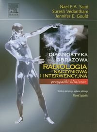 Radiologia naczyniowa i interwencyjna. Przypadki kliniczne Saad Wael E.A., Vedantham Suresh, Gould Jennifer E.