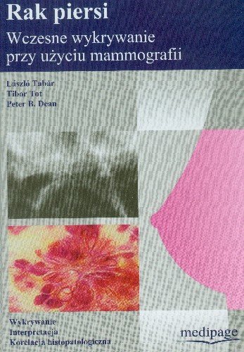 Rak Piersi. Wczesne Wykrywanie przy Użyciu Mammografii Tabar Laszlo, Tot Tibor, Dean Peter B.
