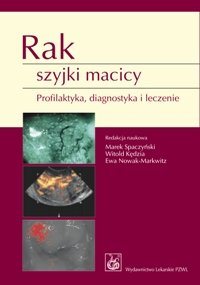 Rak Szyjki Macicy Spaczyński Marek, Kędzia Witold, Nowak-Markwitz Ewa