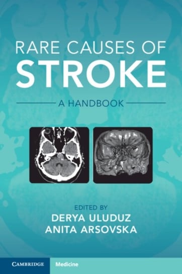 Rare Causes of Stroke: A Handbook Anita Arsovska