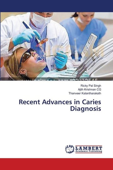 Recent Advances in Caries Diagnosis Singh Ricky Pal