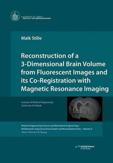 Reconstruction of a 3-Dimensional Brain Volume from Fluorescent Images and its Co-Registration with Magnetic Resonance Imaging Stille Maik