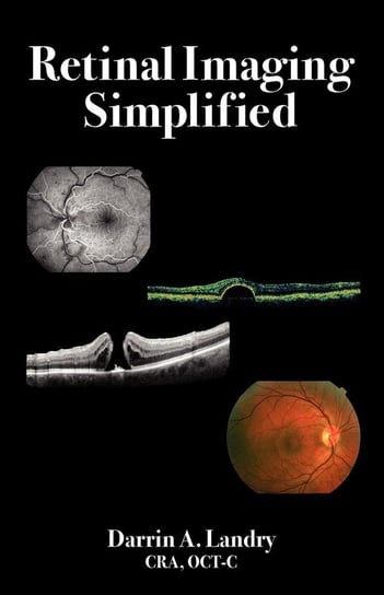 Retinal Imaging Simplified Landry Darrin A
