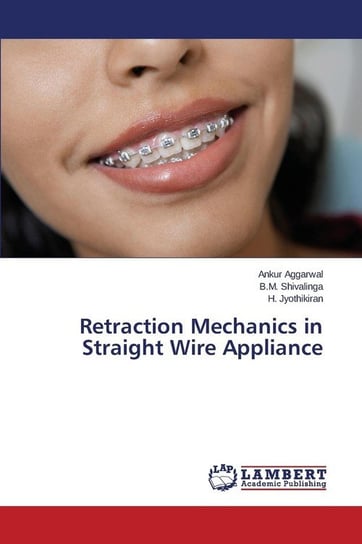 Retraction Mechanics in Straight Wire Appliance Aggarwal Ankur