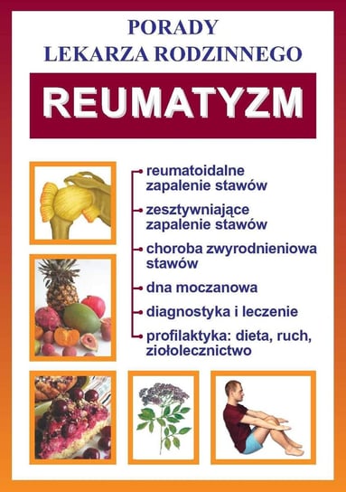 Reumatyzm. Porady lekarza rodzinnego Opracowanie zbiorowe