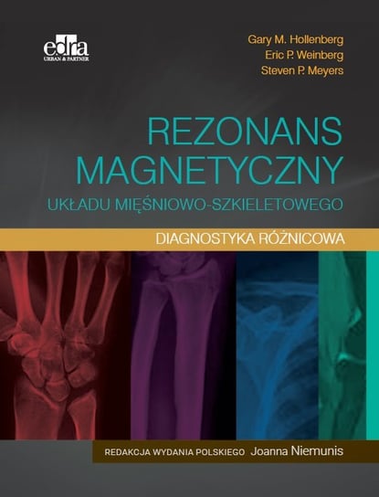 Rezonans magnetyczny układu mięśniowo-szkieletowego Diagnostyka różnicowa Hollenberg Gary M., Weinberg Eric P., Meyers Steven P.